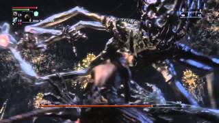 Bloodborne Defiled Chalice Amygdala Strategy Boss Guide [upl. by Davidoff]