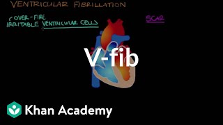 What is ventricle fibrillation Vfib  Circulatory System and Disease  NCLEXRN  Khan Academy [upl. by Bobby]