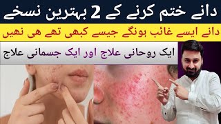 acne control treatment acne pimples remove face wash  dany khatam karne ka best tarika [upl. by Claudette]