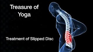 Slip Disc Exercises  Treatment of L4  L5 problems [upl. by Aihsetel678]