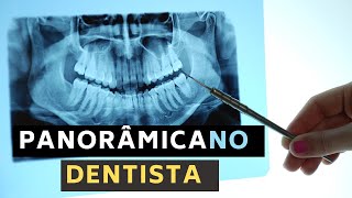 Raio X panorâmico dos dentes Porque fazer a panorâmica dentária em 5 exemplos [upl. by Ainoet670]