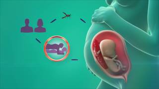 Zika condom use during pregnancy 30sec video spot PSI [upl. by Yves]