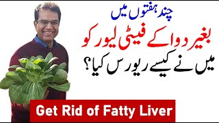 fatty liver symptoms  fatty liver treatment  Detoxify Fatty liver without medicine [upl. by Dadinirt431]