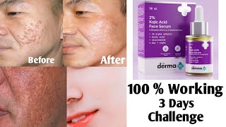 Reduce Black Spots  Acne Pimple MarksIn Just Three Days  The Derma Kojic Acid Face Serum Review [upl. by Busch365]