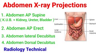 Abdomen xray Projections [upl. by Ritter]