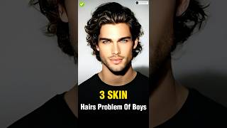 4 Skin amp Hair Problems Every Man Faces ✅  shorts viral [upl. by Phebe]