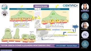 PHM NEFROPATÍA MEMBRANOSA [upl. by Oranneg201]