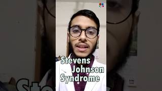 Stevens Johnson Syndrome  Sulfonamide  Penicillin  Antibiotics  Adverse effects [upl. by Nylaret]