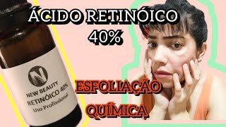 Ácido Retinóico 40  Esfoliação Química em Casa [upl. by Anaujat22]