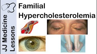 Familial Hypercholesterolemia  Genetics Pathophysiology Symptoms and Treatment [upl. by Gav532]