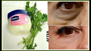 7 DAYS TO REMOVE DARK CIRCLES EYE BAGS  EYE WRINKLES AND LINES Khichi Beauty [upl. by Aneetsirk]