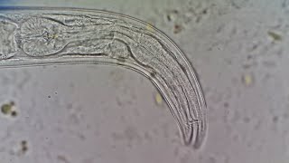 Soil nematode  free living nematode Rhabditida [upl. by Mason]