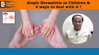 ATOPIC DERMATITIS in Children amp 9 ways to deal this Infantile EczemaDrD A SatishDoctors’ Circle [upl. by Xirdnek]