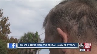 63yearold man hit in head with hammer [upl. by Asiram18]