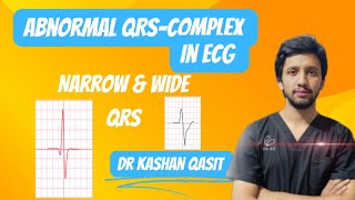 Abnormal QRS Complex In ECG QRS ComplexNarrow amp Wide QRS ECGEKGDr Kashan Qasit [upl. by Choo]