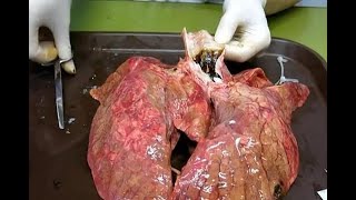 Video muestra el efecto de 60 cigarros en los pulmones [upl. by Sprage]