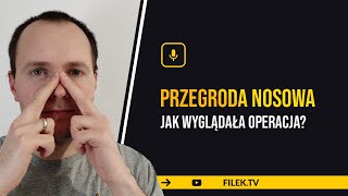 Przegroda nosowa  operacja  jak to wyglądało  P 6 [upl. by Nylra]