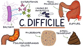 C difficile toxin AB rapid test — detection of C difficile and toxins AB [upl. by Akived]