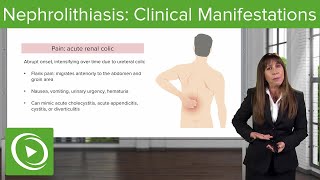 Nephrolithiasis Clinical Manifestations amp Differential Diagnosis with Case – Nephrology  Lecturio [upl. by Eoin]