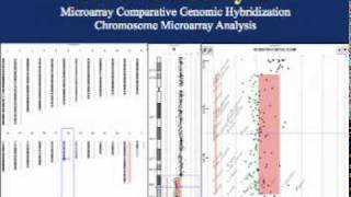 Podcast 3 How is routine chromosome analysis different from molecular analysis [upl. by Anined]