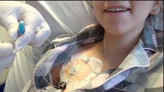 SURGERY VLOG PART FIVE Deaccessing my port for the first time and going home [upl. by Leslie]