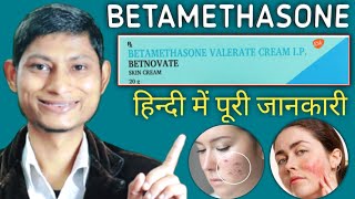 betamethasone valerate cream ip  betamethasone dipropionate cream  betnovate cream ke fayde [upl. by Arlie]