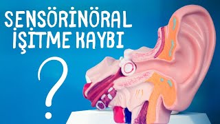 Sensörinöral İşitme Kaybı  Tanımı  Nedenleri  Tipik Odyometrik Bulgusu  Tedavi Metotları [upl. by Aibonez]