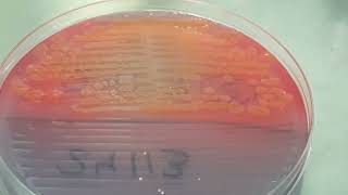 E coli Pseudomonas aeruginosa and Citrobacter freundii colony morphology on CLED agar [upl. by Amora196]