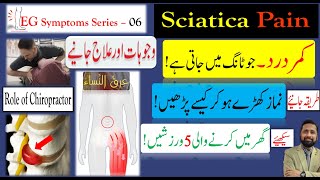 Sciatica Low back Pain عرق النساء  کمر درد  Dr Ali Hassan [upl. by Suzzy]