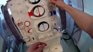 How to setup dialysis fresenius 5008 machine Frenchdialyse [upl. by Analeh]