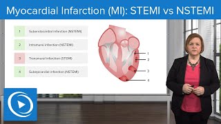 Myocardial Infarction MI STEMI vs NSTEMI – MedSurg Nursing  Lecturio Nursing [upl. by Garfinkel]