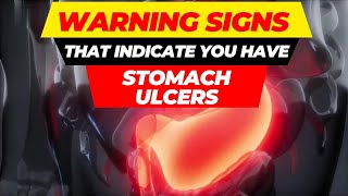 top 10 warning signs of stomach ulcers [upl. by Starobin]