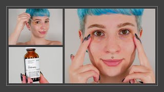 The Ordinary Caffeine Solution Review with Before and After Pictures amp Demo [upl. by Candi65]