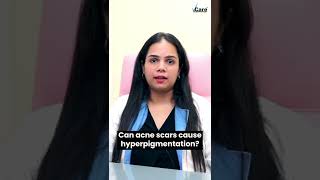 Acne Scars amp Hyperpigmentation  VCare Hair amp Skin Clinics  Skincare Tips [upl. by Geoffrey]