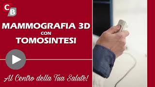 Mammografia 3D con tomosintesi [upl. by Kornher]