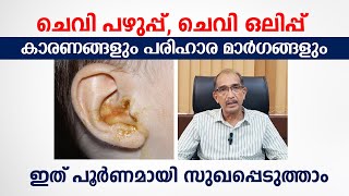 ചെവി പഴുപ്പ് ചെവി ഒലിപ്പ് പൂർണമായി സുഖപ്പെടുത്താം  Dr Viswanathan Kavathur  Arogyam [upl. by Ateekan]