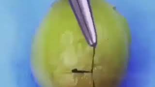 Surgery on a grape 🍇⠀      med surgicalteaching surgery surgeon medical [upl. by Thea48]