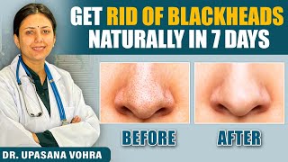 Skin Transformation Challenge  Remove Blackhead Naturally in 7 Days💕  Upasana Ki Duniya [upl. by Zigrang439]