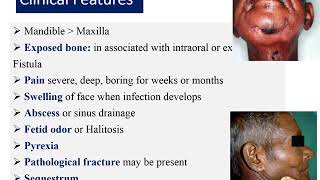 Osteoradionecrosis Etiology Pathophysiology Clinical Features Management [upl. by Deuno480]