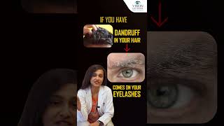 5 Causes Stye on Your Eyelid   How To Get Rid Of Stye From Eye  Vision Eye Centre [upl. by Eidas]