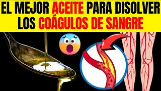 Derretir coágulos de SANGRE de forma NATURAL 6 ACEITES poderosos PRINCIPALES [upl. by Chandos]