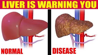 HOW CAN LIVER DISEASES AND CAUSES SYMPTOMS TREATMENT  Nature Cure Fit [upl. by Cate]