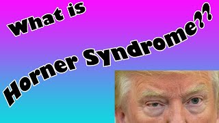 Horners Syndrome Explained [upl. by Richel]