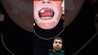 dentist smile teethwhitening beauty lips dental veneers [upl. by Natka680]