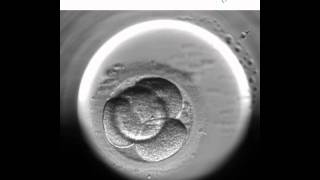 Embryoscope 1  Nuevo método de cultivo y selección embrionaria [upl. by Legnaleugim205]