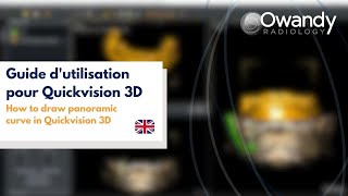 2 How to draw panoramic curve in Quickvision 3D [upl. by Jennica176]