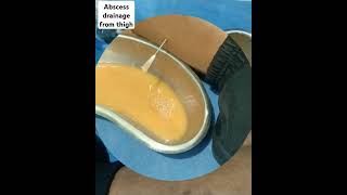 abscess drainage from thigh viral heelpain medical shortvideo [upl. by Blondie]