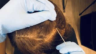 ASMR Lice CheckScalp ScratchingHair PartingSOFT WHISPERING [upl. by Wyne]