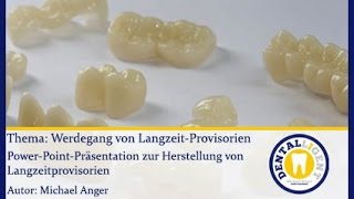 ZahntechnikGRATISWerdegang von Langzeitprovisorien [upl. by Aley876]