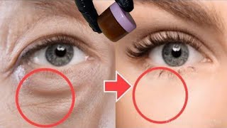 How to remove wrinkles around the eyes sagging eyelids circles and bags under the eyes [upl. by Craggie158]